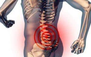 Что такое спондилолистез и как его лечить