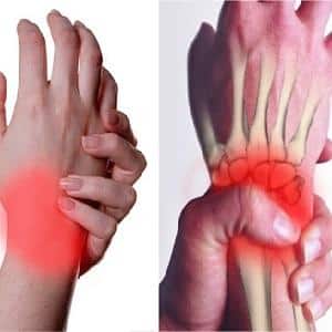 Что делать, если болит кисть руки