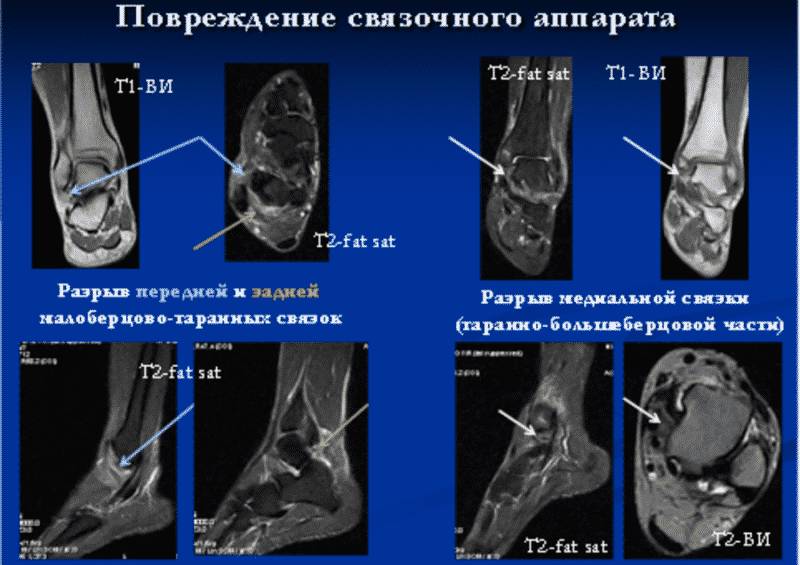 Снимки