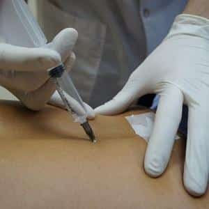 Что такое блокада в медицине