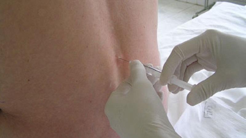 Что такое блокада в медицине