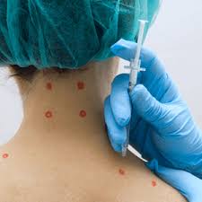 Что такое фармакопунктура