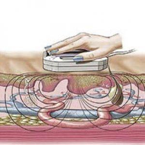 Что такое физиотерапия и её виды