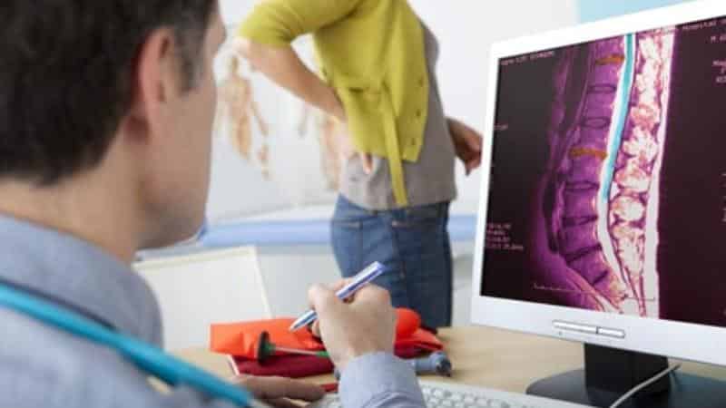 Миелография позвоночника