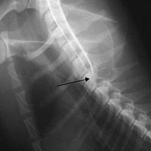 Что такое остистые отростки