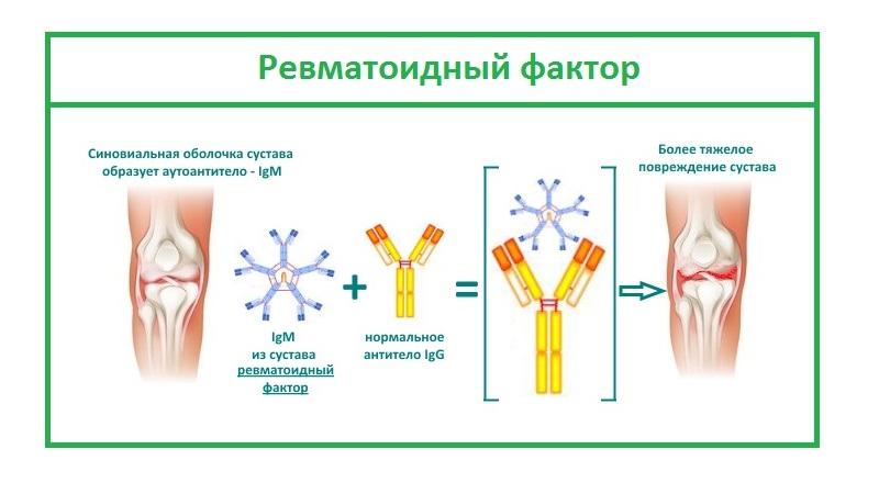 Что такое ревматоидный фактор