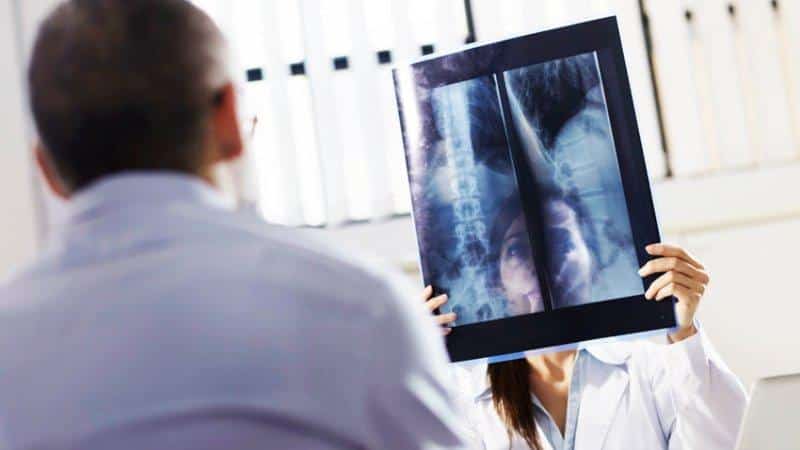 Что такое сакрализация позвонка и как её лечить