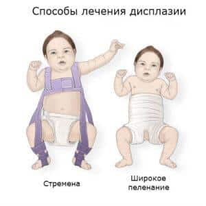 Что такое широкое пеленание и для чего оно применяется