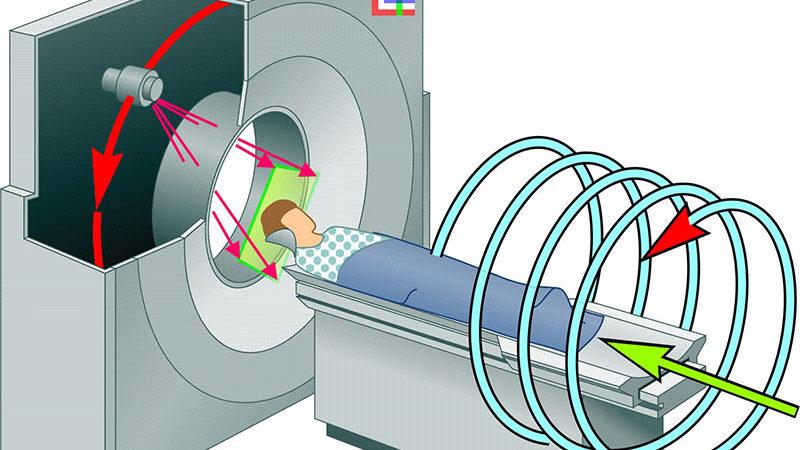 Что такое спиральная компьютерная томография