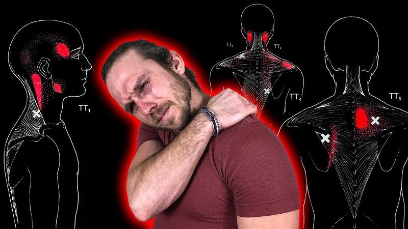 Что такое триггерные точки