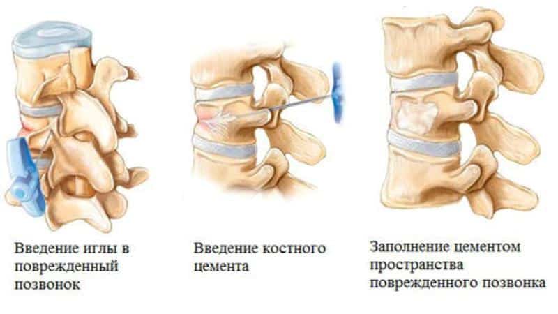 Техника выполнения