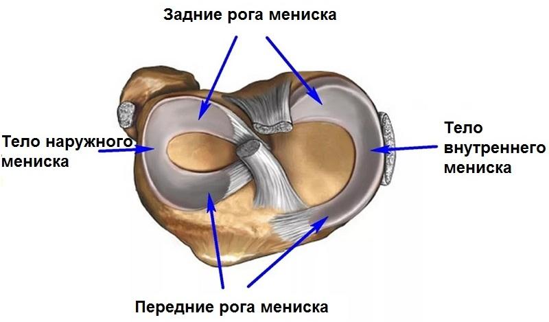 Как лечить дегенеративные изменения менисков коленного сустава