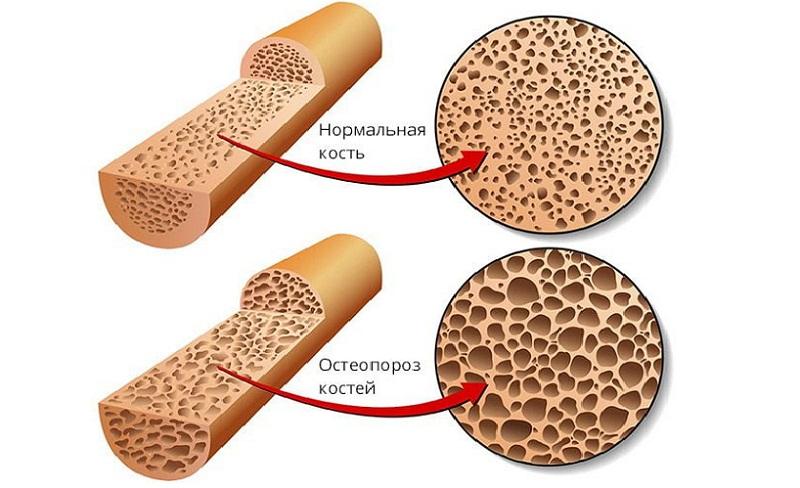 Что такое денситометрия и как её делают