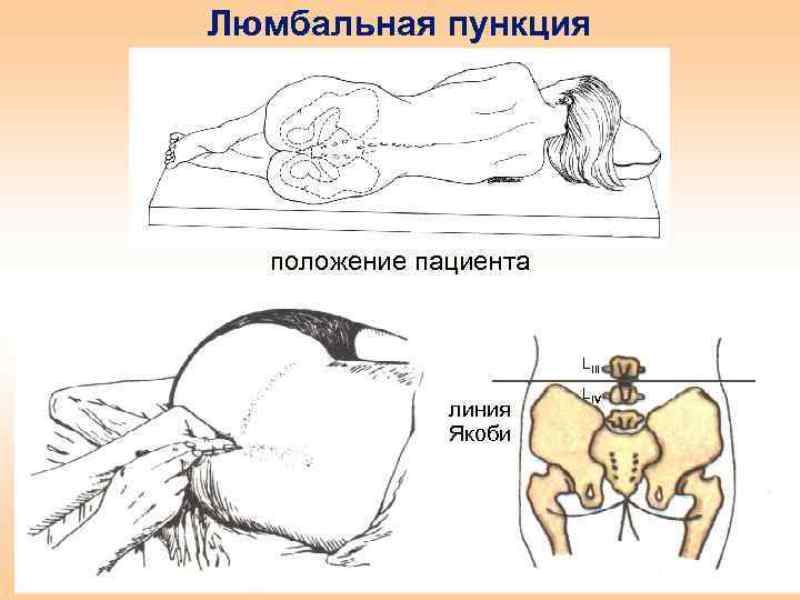 Проведение процедуры
