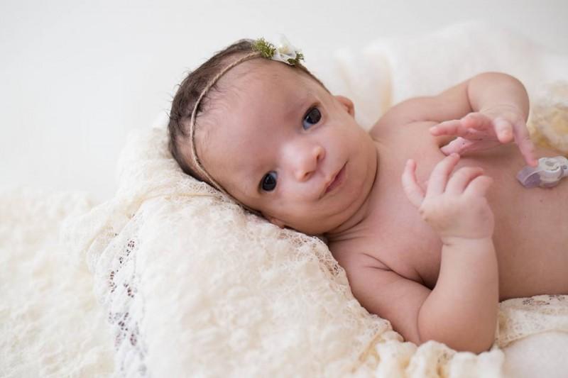 Как лечить синдром Тричера-Коллинза