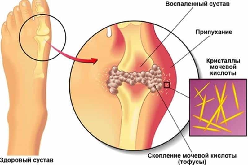 Тофусы