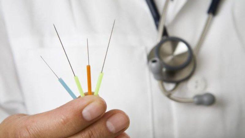Помогает ли иглоукалывание при остеохондрозе