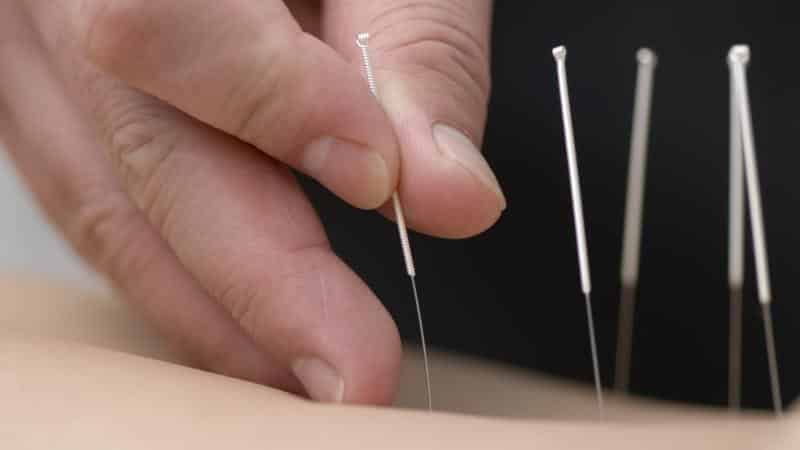 Помогает ли иглоукалывание при остеохондрозе