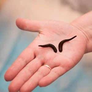 Как лечить артроз стопы