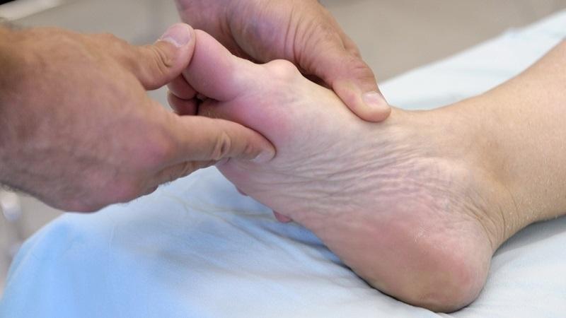 Как лечить деформацию пальцев ног и рук