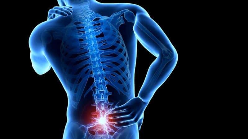 Как лечить деформирующий спондилез поясничного отдела