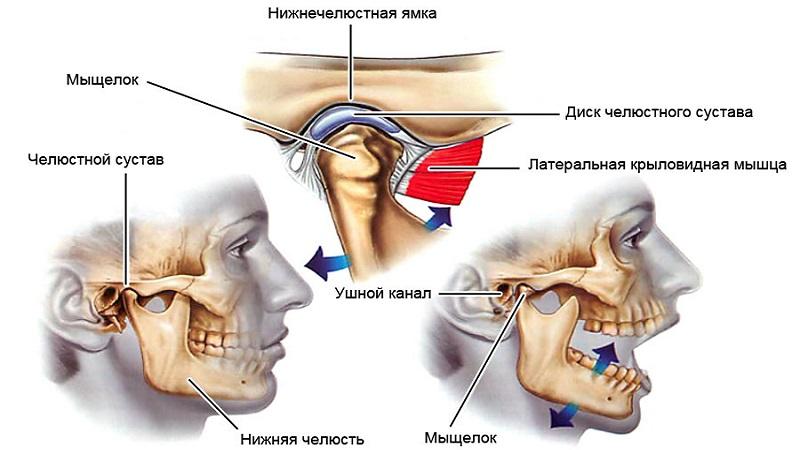 Как лечить дисфункцию ВНЧС