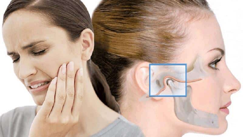 Как лечить дисфункцию ВНЧС