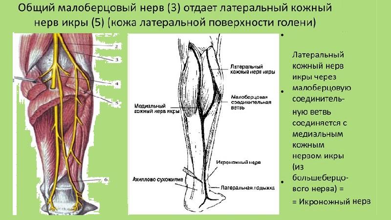 Как лечить нейропатию малоберцового нерва
