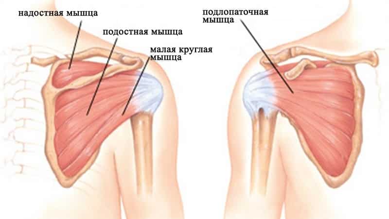 Как лечить повреждение сухожилия надостной мышцы плеча