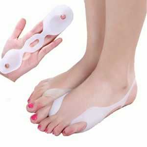 Как лечить вальгусную деформацию стопы