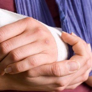 Как лечить выбитый палец на руке