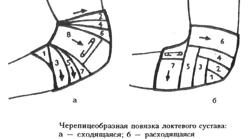 Как наложить черепашью повязку