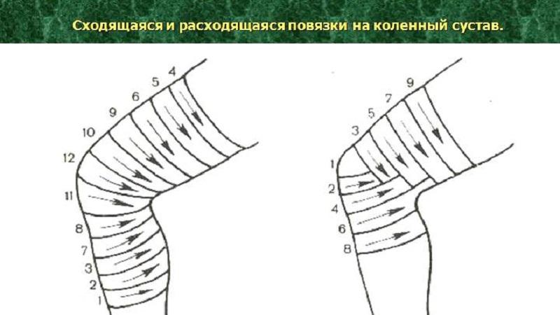 Как наложить черепашью повязку