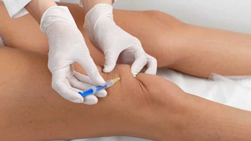 Как применять препарат Интраджект