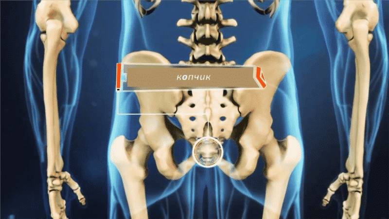 Как проходит операция по удалению копчика
