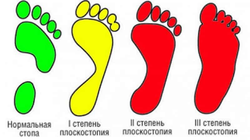 Как устроена стопа человека