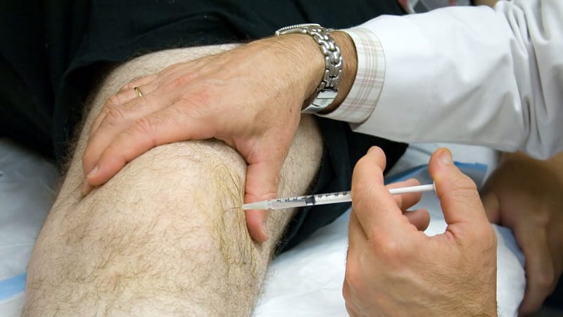 Какие уколы делают в коленный сустав при артрозе