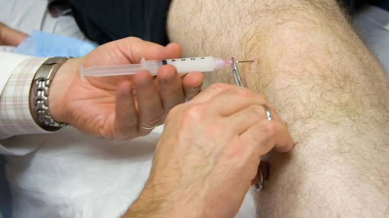 Какие уколы делают в коленный сустав при артрозе