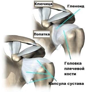 Как лечить капсулит плечевого сустава