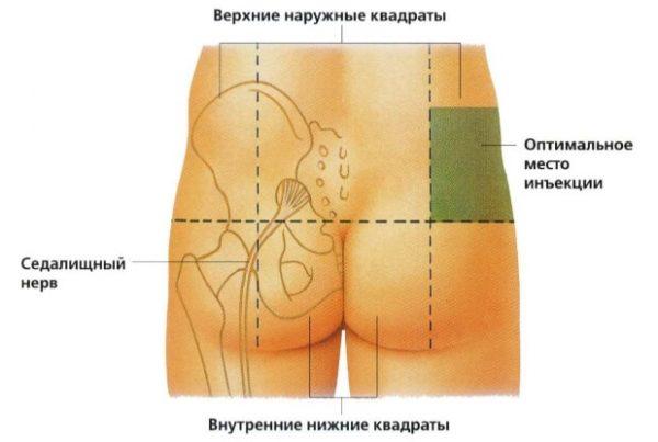 Как применять препарат Кеторол