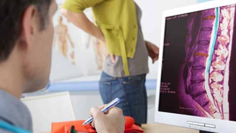 Как лечить артроз копчика