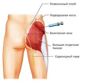 Как применять препарат Ксефокам