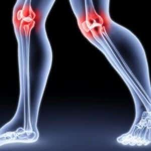 Что делать с болью в суставах при климаксе