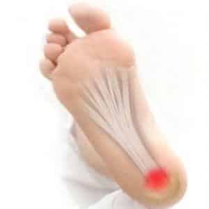 Как происходит лечение пяточной шпоры ударно-волновой терапией