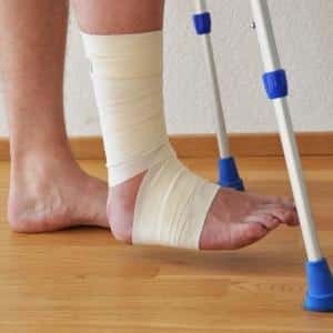 Что такое стрессовый перелом