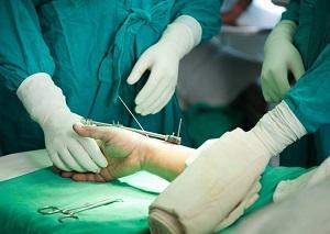 Как лечить стенозирующий лигаментит пальцев