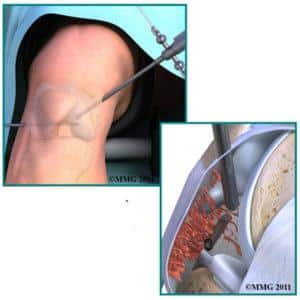 Что делать, если болит колено в состоянии покоя