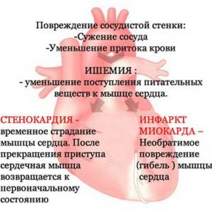 Осложнения
