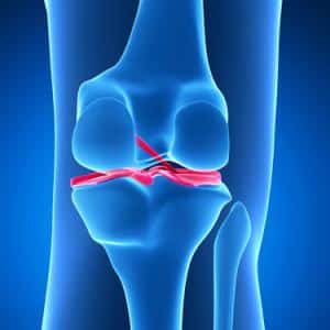 Операции на коленном суставе