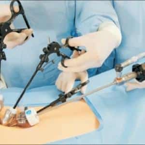 Как оперируют грыжу позвоночника